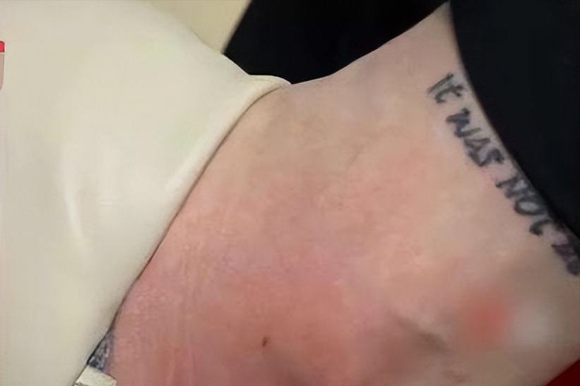 回顾：春暖花开，女大学生穿裤子遭马蜂蜇，被蛰部位纹身引发热议