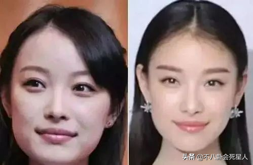 5位意想不到的“后天美女”，动脸克制又理智，美得毫无痕迹