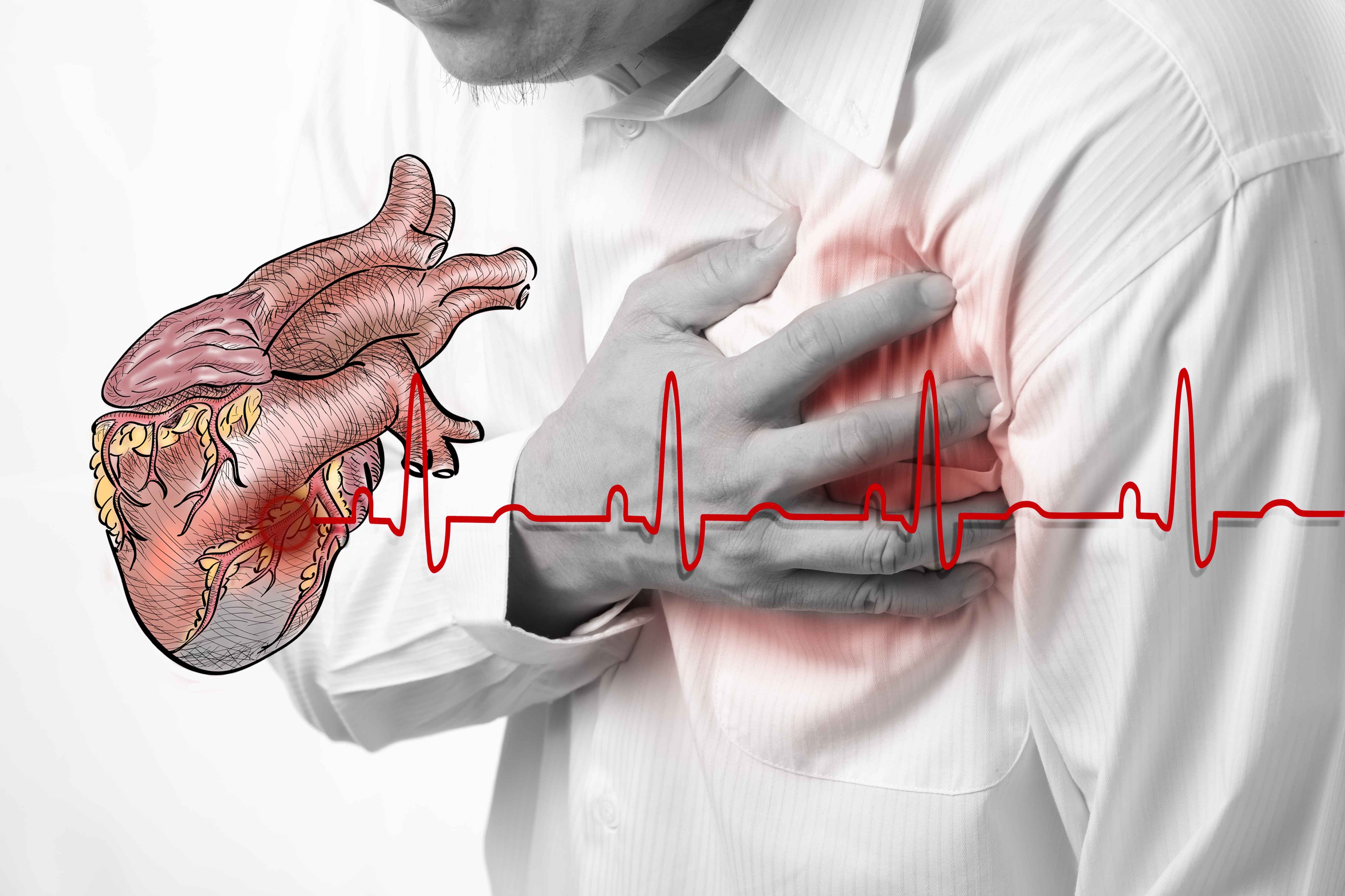 心脏造影，不是常规检查，但若有这5种情况，需及时做心脏检查