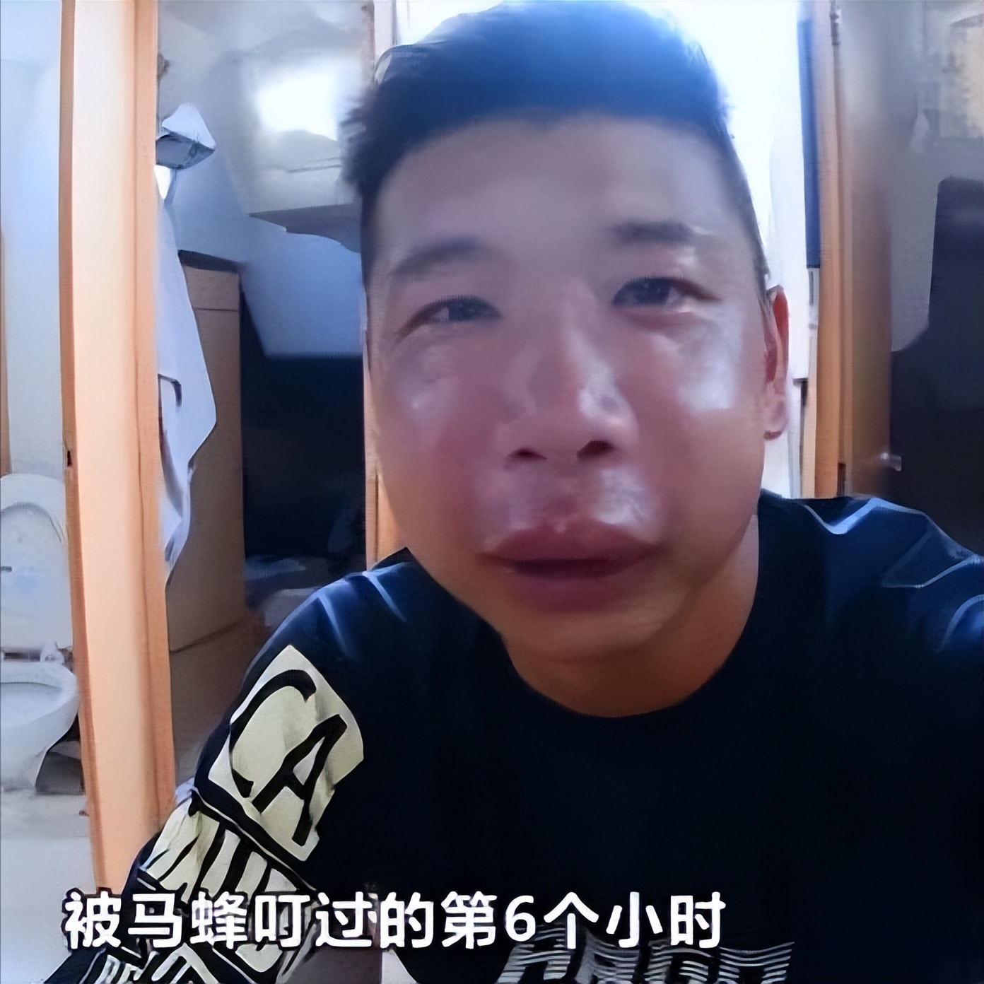 回顾：春暖花开，女大学生穿裤子遭马蜂蜇，被蛰部位纹身引发热议