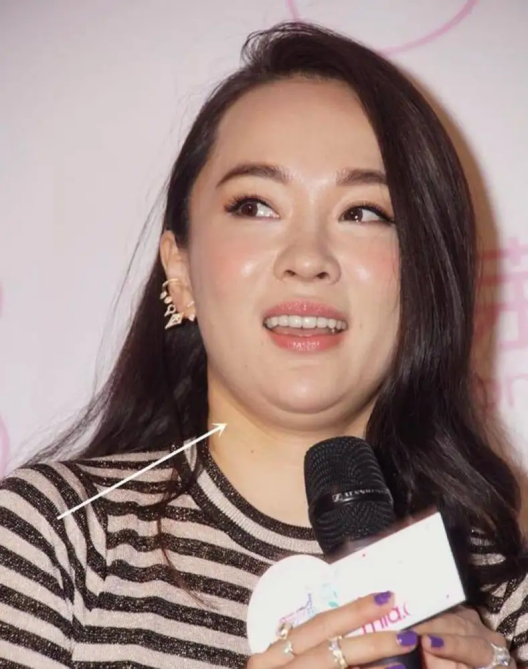 怀孕后胖得离谱的女明星，有人飙升55斤，有人直逼190胖若两人