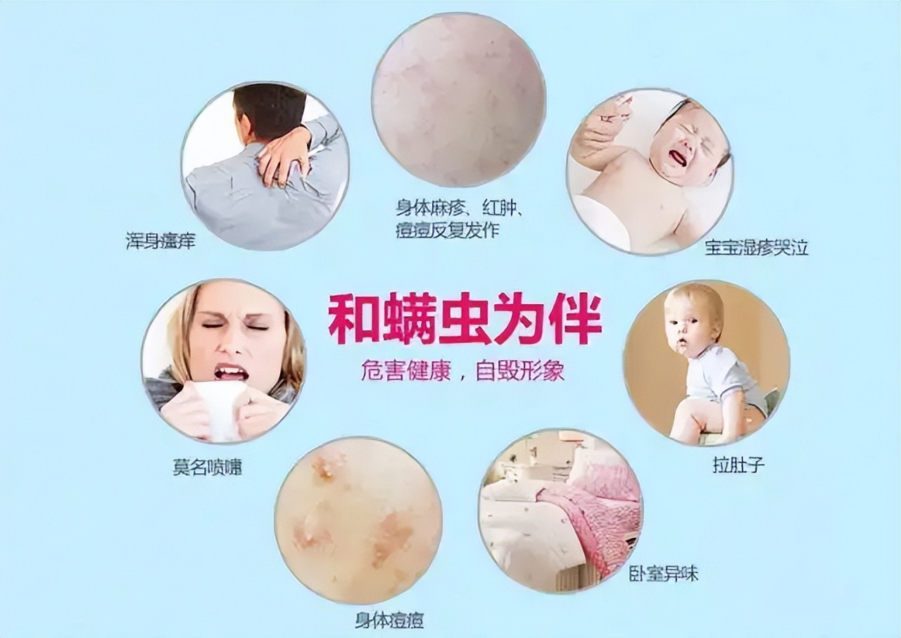 养宠物致眼睑滋生几十只螨虫,螨虫都有哪些危害?如何预防清除?