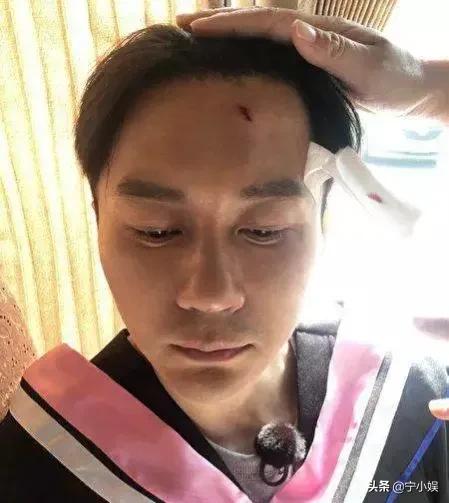 再看录综艺遭遇意外的10位明星：大多令人后怕，有人丢掉性命